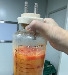 苍南水动力吸脂手术要做多久？